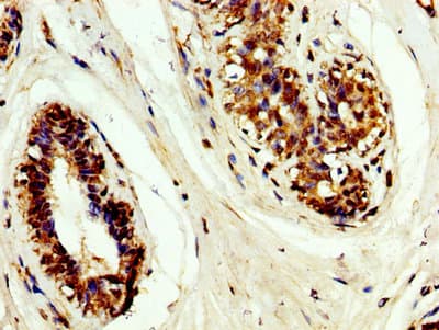 Polyclonal Rabbit anti-Human TIMP3 Antibody (IHC)