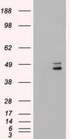 Monoclonal Mouse anti-Human MAP2K4 / MKK4 Antibody (clone OTI2D5, IHC, IF, WB)