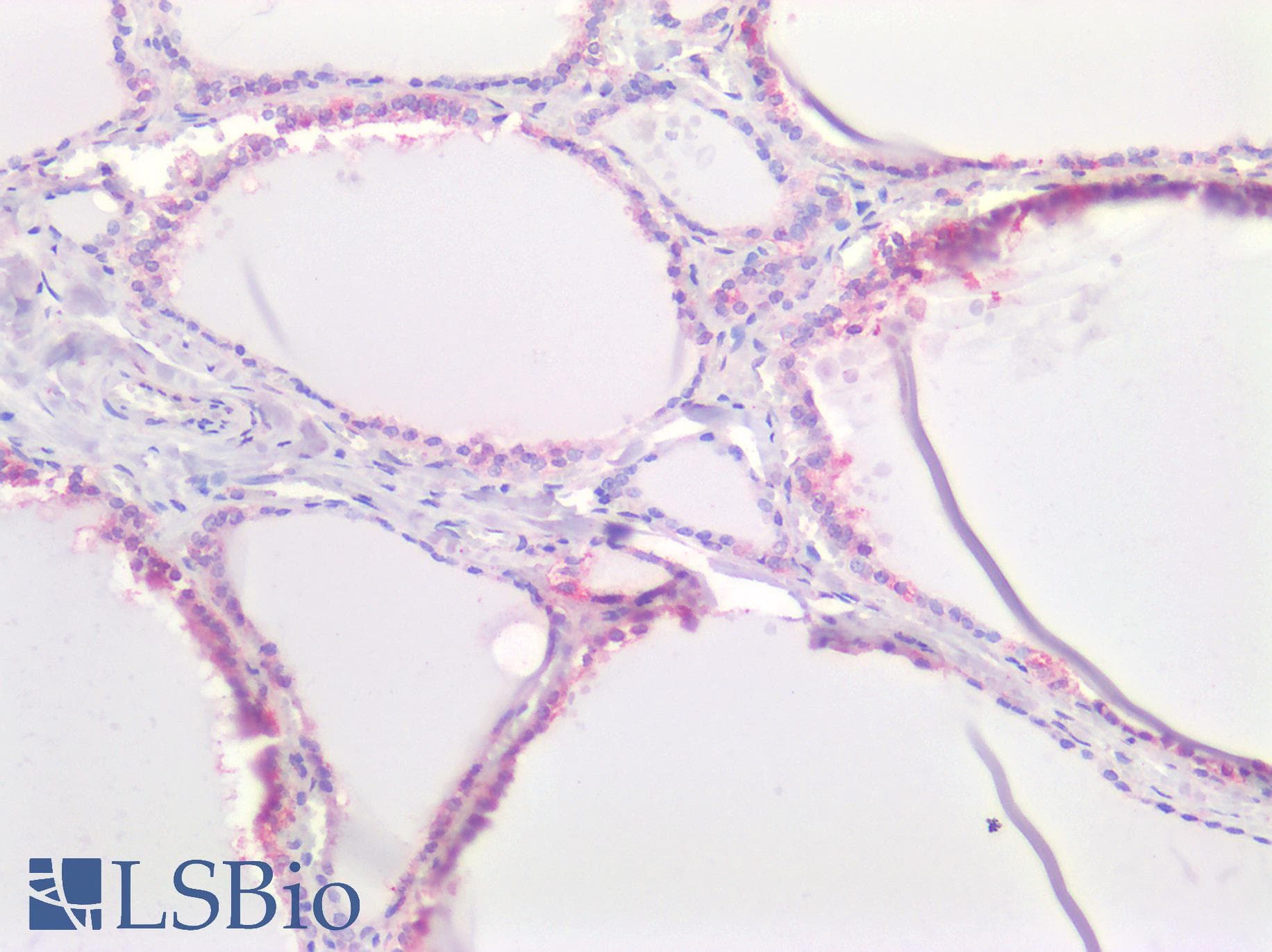 PathPlus™ Polyclonal Rabbit anti-Human SLC16A2 / MCT8 Antibody (Internal, IHC, WB)