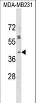 Polyclonal Rabbit anti-Human ABO Glycosyltransferase Antibody (aa41-68, WB)