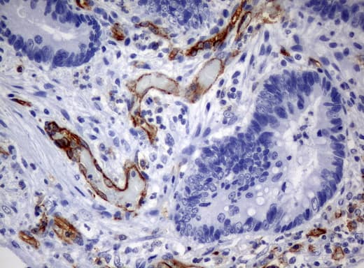 PECAM-1 / CD31 Antibody (clone UMAB31, Carrier-free)
