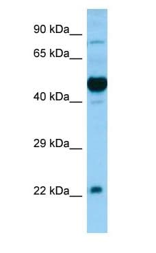 OX1R / Orexin Receptor 1 Antibody (N-Terminus)