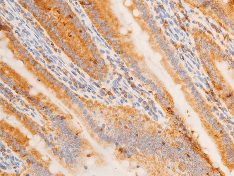 Polyclonal Rabbit anti-Human JUN / c-Jun Antibody (phospho-Tyr170, IHC, WB)