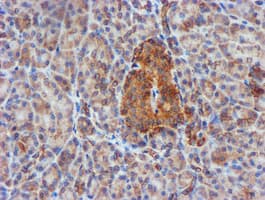 CYB5R3 / B5R Antibody (clone OTI1E8)