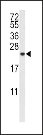 Polyclonal Rabbit anti-Human IL-10 Antibody (aa27-53, IHC, WB)