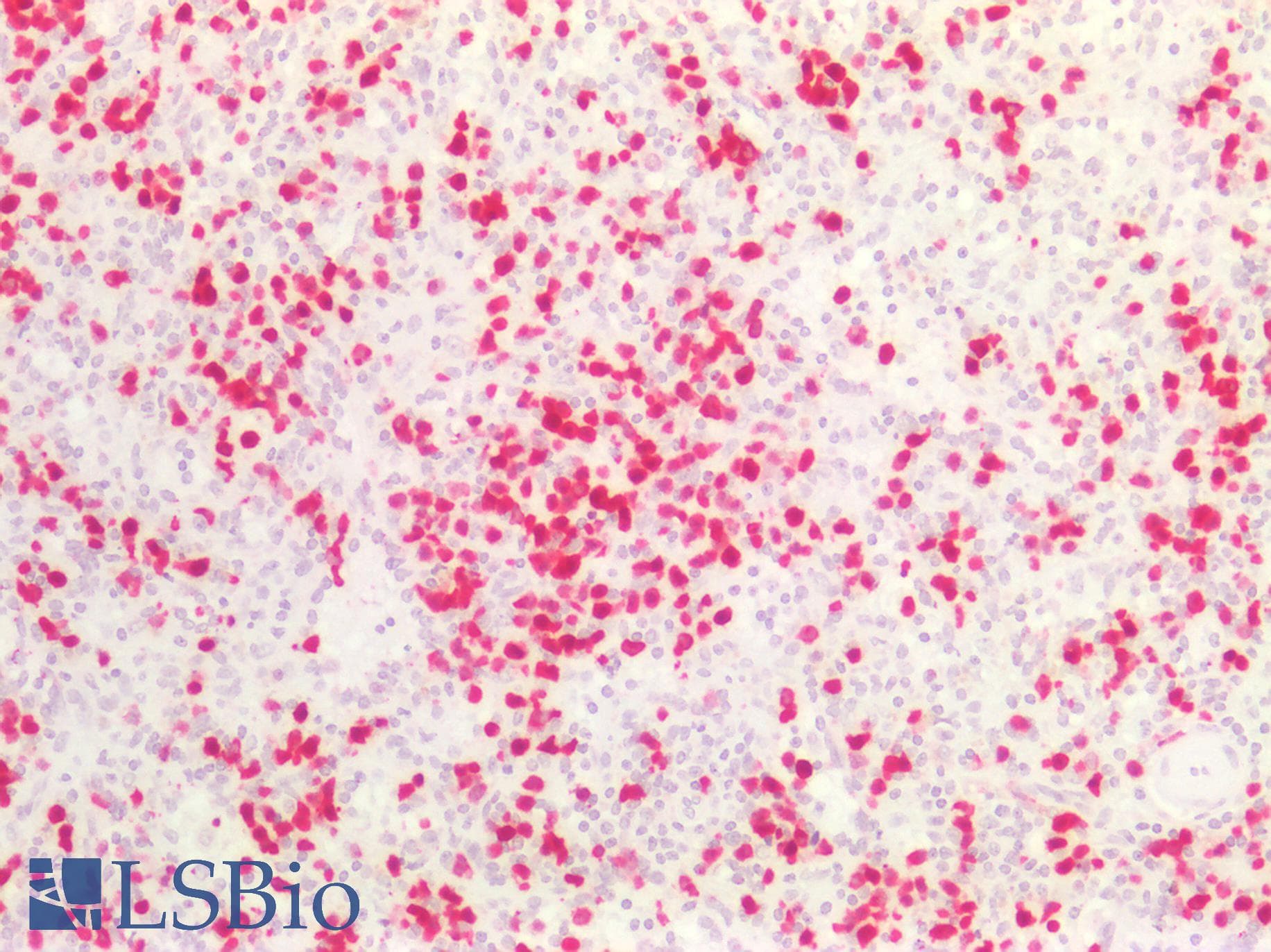 PathPlus™ Monoclonal Mouse anti-Human S100A8 / MRP8 Antibody (clone CF-145, IHC, IF, WB)