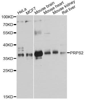PRPS2 Antibody