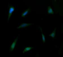 FAK / Focal Adhesion Kinase Antibody (clone OTI4D11)