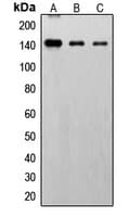 Polyclonal Rabbit anti-Human FGFR1 / FGF Receptor 1 Antibody (phospho-Tyr766, IHC, WB)