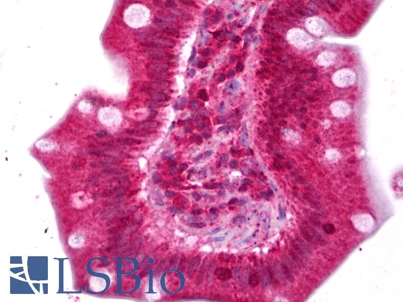 IHC-plus™ Polyclonal Rabbit anti-Rat ENPP2 / Autotaxin Antibody (IHC, WB)