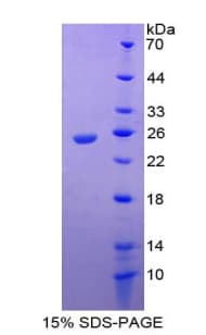 Mouse IL17RE Protein (Recombinant His)