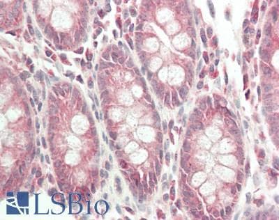 IHC-plus™ FARSA Antibody (aa2-508)