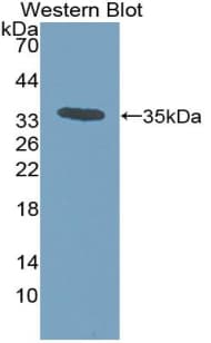 CCL7 / MCP3 Antibody (aa24-99)