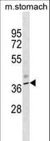 Polyclonal Rabbit anti-Mouse KCNJ11 / Kir6.2 Antibody (aa1-27, WB)