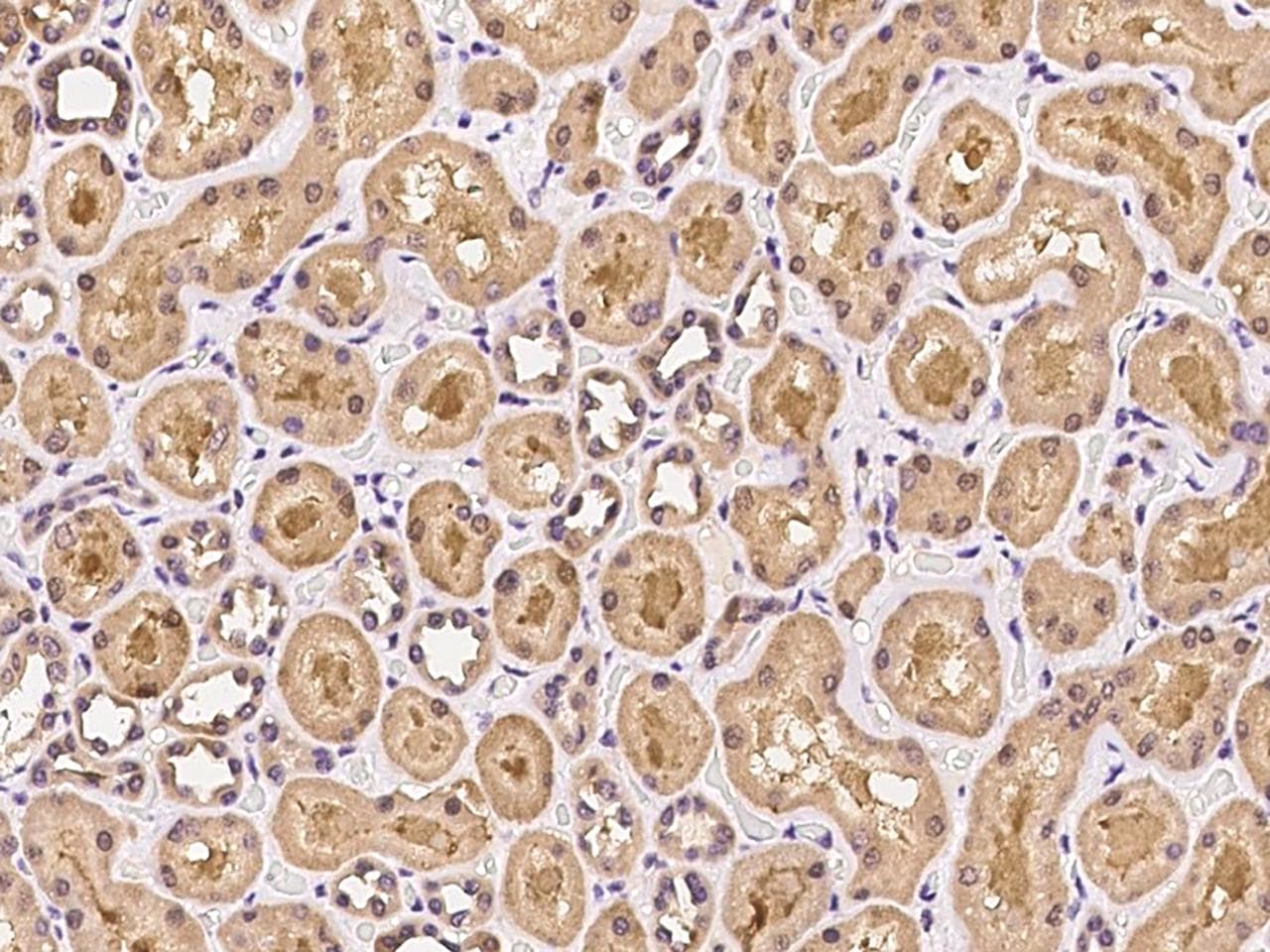 PTPN9 / MEG2 Antibody
