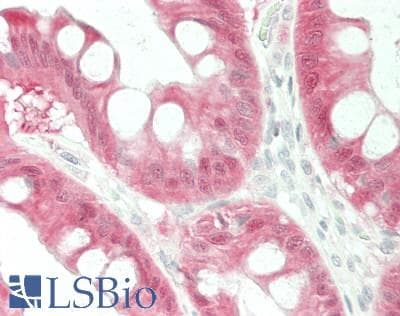IHC-plus™ TXN / Thioredoxin / TRX Antibody (aa 2-105)