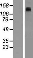 ADCY8 / Adenylate Cyclase 8 Protein (Over-Expression Lysate Myc-DDK (Flag))