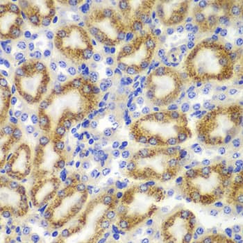 TNFSF11 / RANKL / TRANCE Antibody