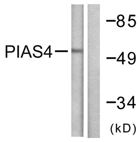 IHC-plus™ PIAS4 / PIASY Antibody (aa451-500)