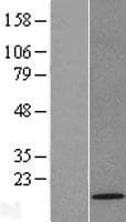 TOMM22 / TOM22 Protein (Over-Expression Lysate Myc-DDK (Flag))