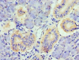 Polyclonal Rabbit anti-Human TNFSF13 / APRIL Antibody (aa105-247, IHC, WB)