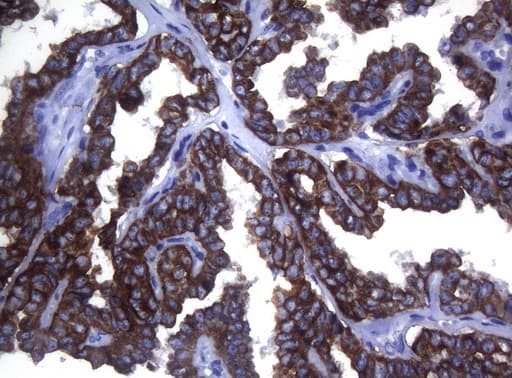 Monoclonal Mouse anti-Human SYNC / SYNCOILIN Antibody (clone OTI5B8, Carrier-free, IHC, WB)