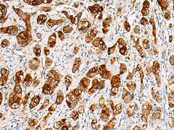 SAA1 / SAA / Serum Amyloid A Antibody