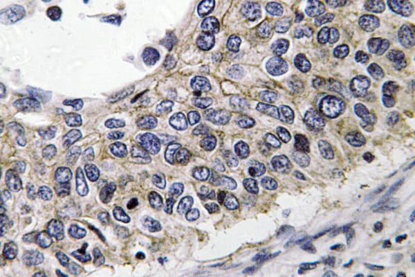 PRDX3 / Peroxiredoxin 3 Antibody (Lys93)
