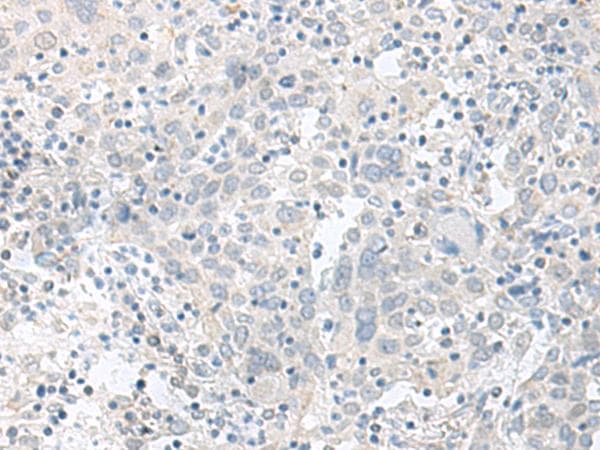 TIMM8A Antibody