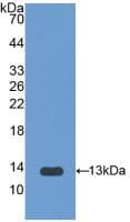 Rat IL1R1 Protein (Recombinant His, N-Terminal)