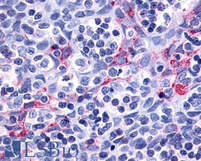 IHC-plus™ P2RY11 / P2Y11 Antibody (Cytoplasmic Domain)