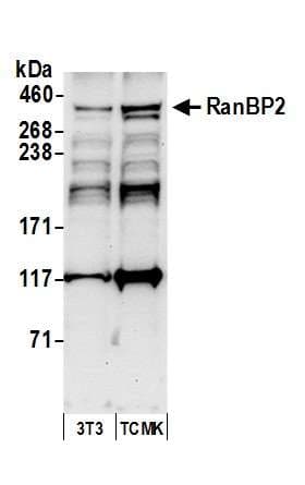 IHC-plus™ RANBP2 / TRP1 Antibody (aa1050-1100)