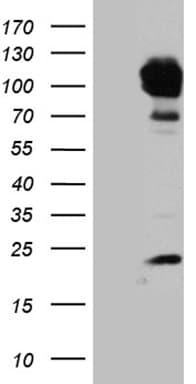 PYGM Antibody (aa698-842, clone OTI5D1)