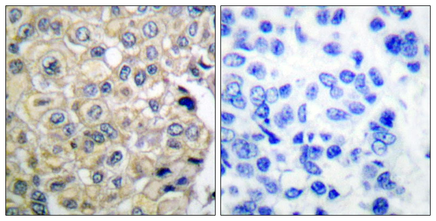 FGFR3 Antibody