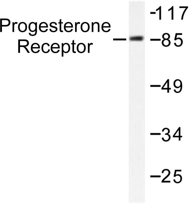 PR / Progesterone Receptor Antibody (Val184)