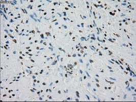 Monoclonal Mouse anti-Human PRKY Antibody (clone OTI4G7, Carrier-free, IHC, IF, WB)