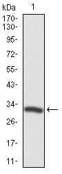 TWF1 / PTK9 Antibody (clone 7C11)