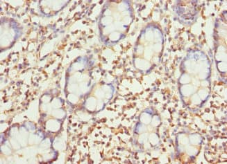 SAR1A / SAR1 Antibody