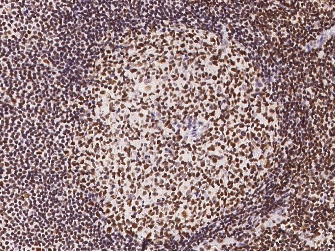 NUP50 Antibody
