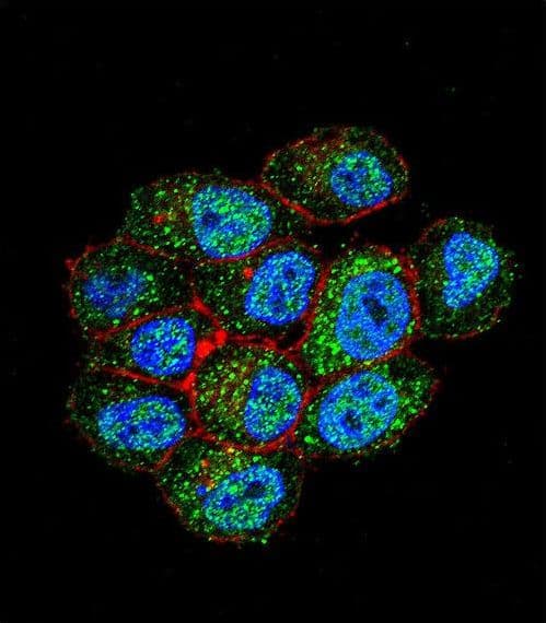 Polyclonal Rabbit anti-Human TSPYL6 Antibody (aa206-235, IHC, IF, WB)