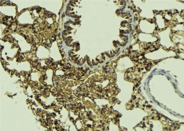 Polyclonal Rabbit anti-Human SMAD5 Antibody (IHC, IF, WB)