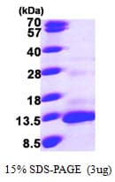 Human CCL13 / MCP4 Protein (Recombinant His)