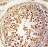 Polyclonal Rabbit anti-Human SPAG9 Antibody (aa91-120, IHC, WB)