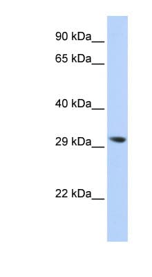 LYPLA2 Antibody (N-Terminus)