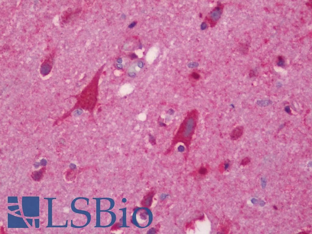 IHC-plus™ NDUFS6 Antibody (aa75-124)