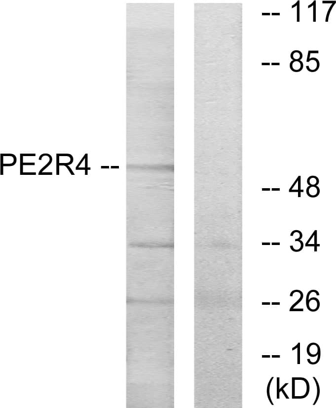Polyclonal Rabbit anti-Human PTGER4 / EP4 Antibody (aa321-370, IF, WB)