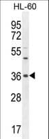 OR1J4 Antibody (aa275-303)
