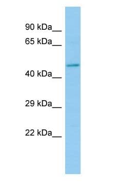 Polyclonal Rabbit anti-Rat HEPACAM2 Antibody (aa35-84, WB)