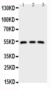 IRAK4 / IRAK-4 Antibody (aa45-59)