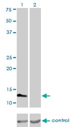 Monoclonal Mouse anti-Human FABP3 / H-FABP Antibody (clone 4F6-1D6, WB)